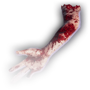 Severed Arm image