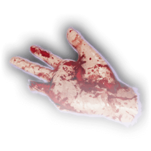 Severed Hand image